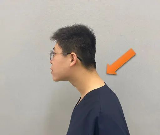 거북목증상이있는남성사진