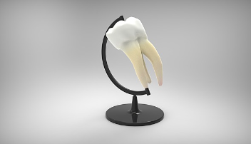 임플란트 종류와 선택 방법