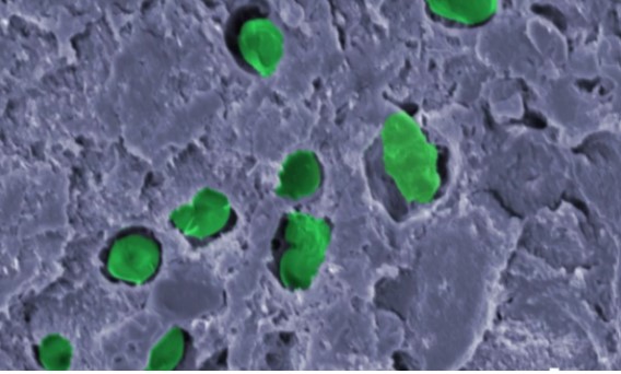 시아노박테리아