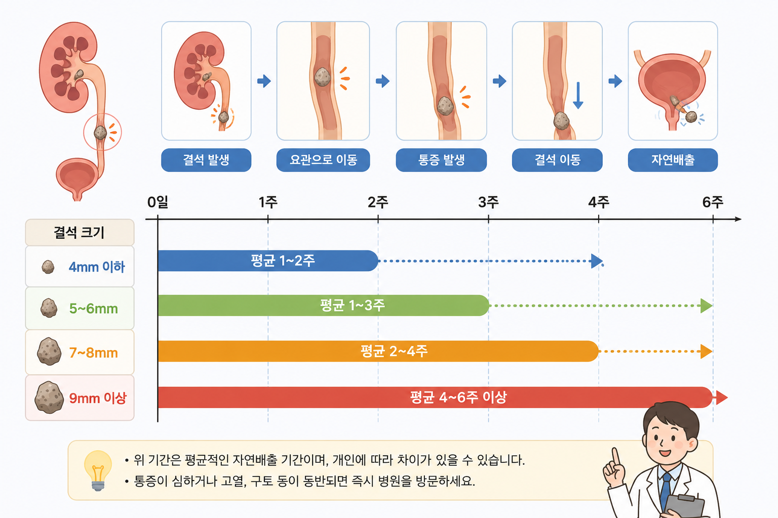 요로결석 자연배출
