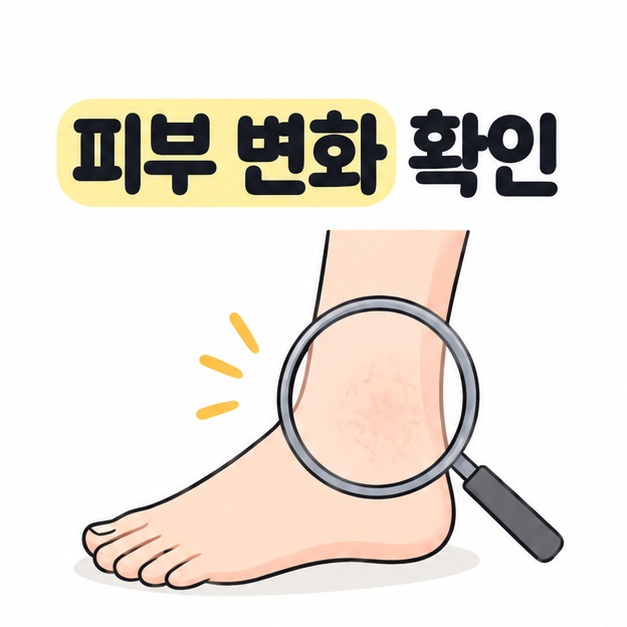 피부 변화를 확인하라는 문구와 발목 주변을 관찰하는 일러스트