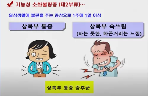 기능성 소화불량증의 원인 중 하나로 상복부통증증후군