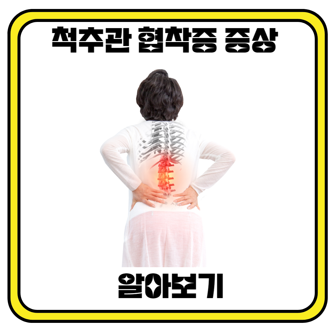 척추관 협착증 증상에 대해서 알아봅시다.