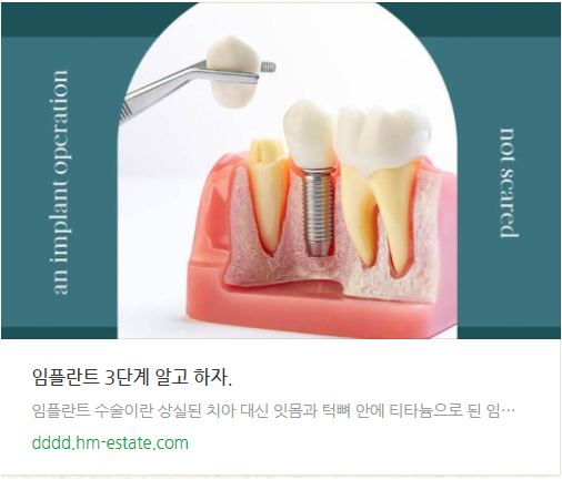 임플란트 시술 3단계