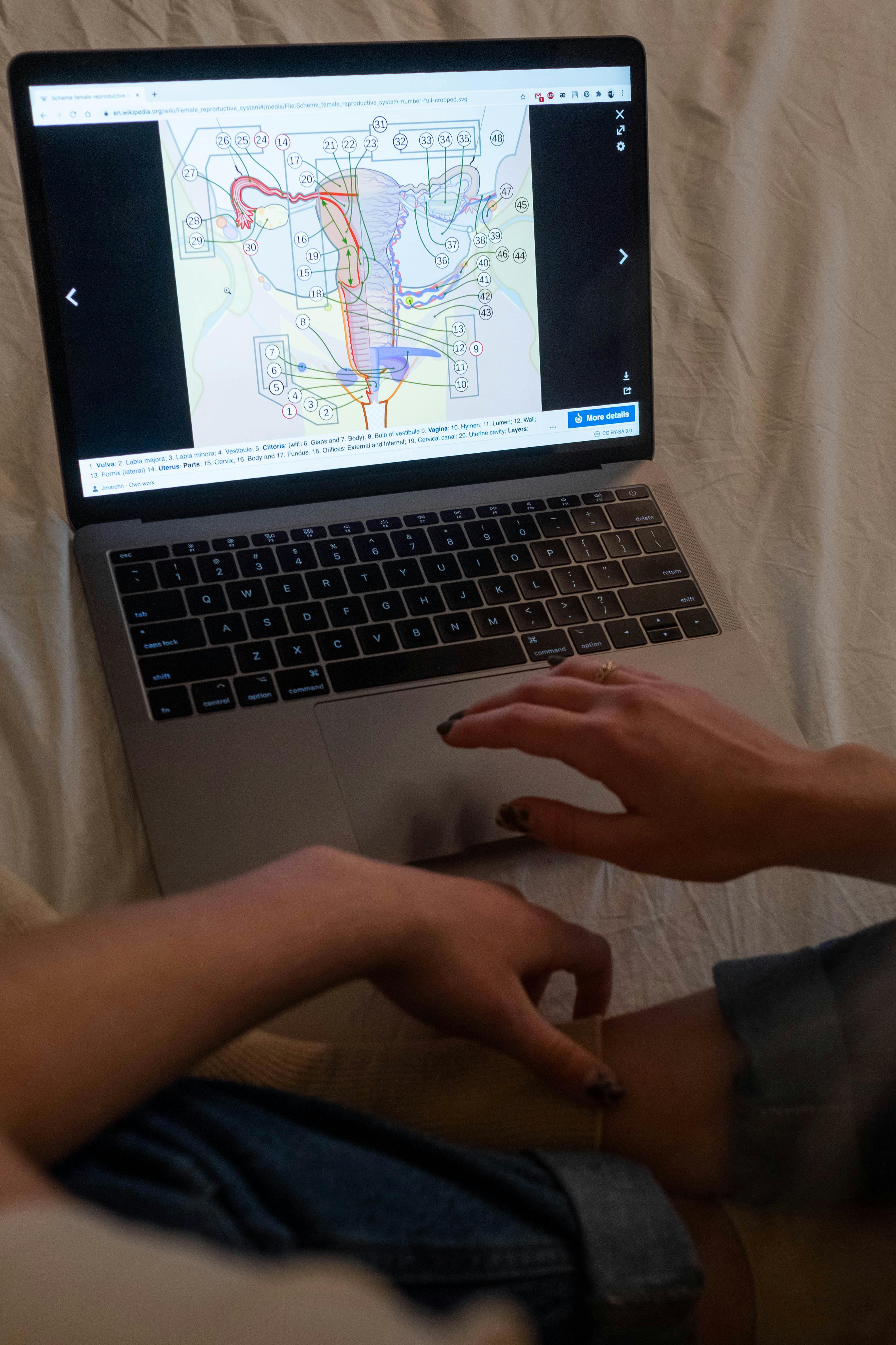 자궁내막증의 증상