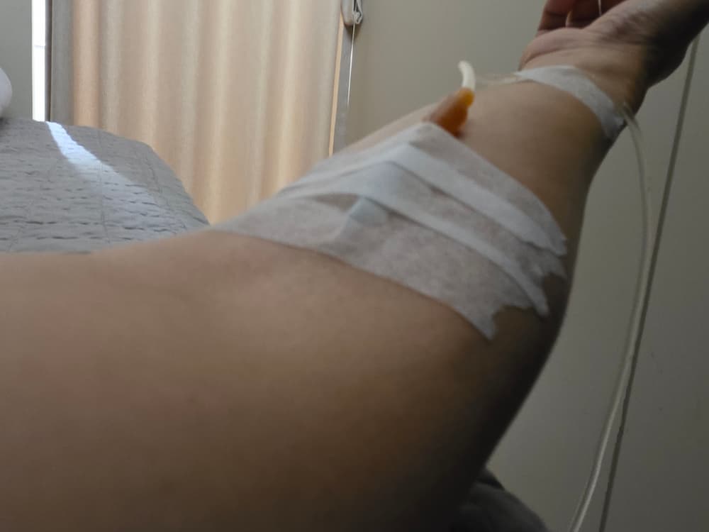 매너리즘을 부수는 미세한 변화