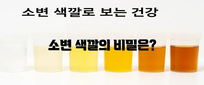 소변 색깔로 보는 건강 한번에 알아보기