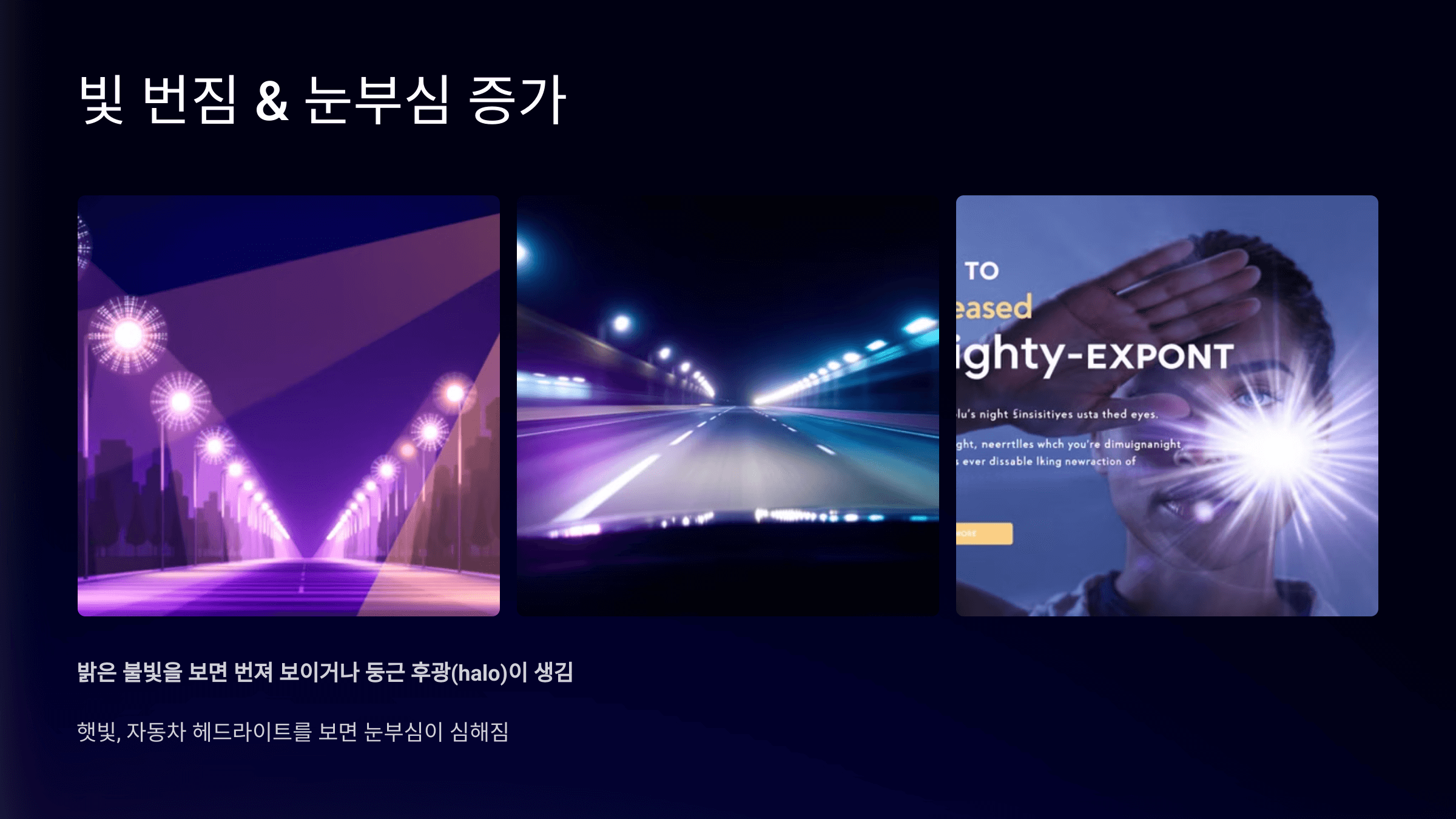 녹내장과 관련된 사진입니다.