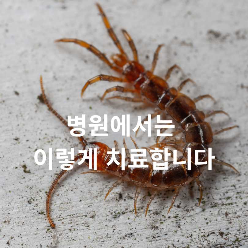 지네에 물리면 증상부터 치료까지, 꼭 알아야 할 응급 대처법