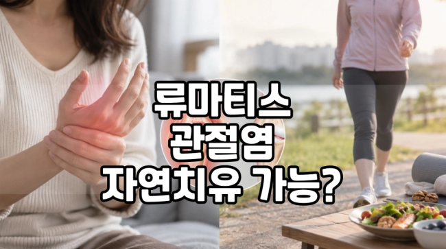 류마티스 관절염 자연치유 가능