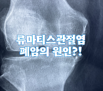 류미티스관절염이 폐암의 원인