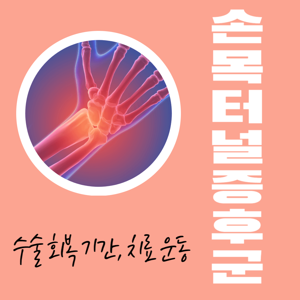 손목터널증후군 수술 회복 기간과 치료 운동