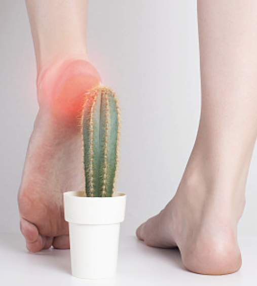 발바닥통증의 원인 20