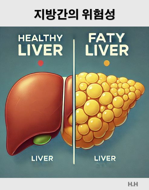 지방간의 위험성