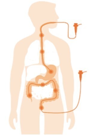 위 대장 내시경 썸네일