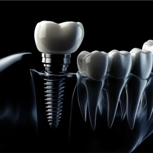 치아 엑스레이 사진