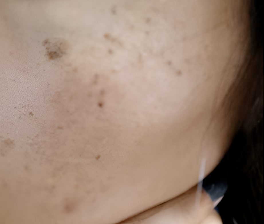 이지듀 선세럼 내돈내산 효과