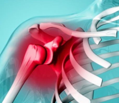 오십견 증상 및 치료방법