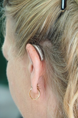 돌발성난청 장애등급