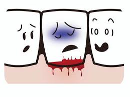 잇몸 염증 베스트