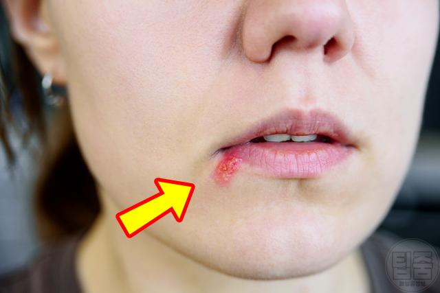 면역력 올리는 음식 하루권장량