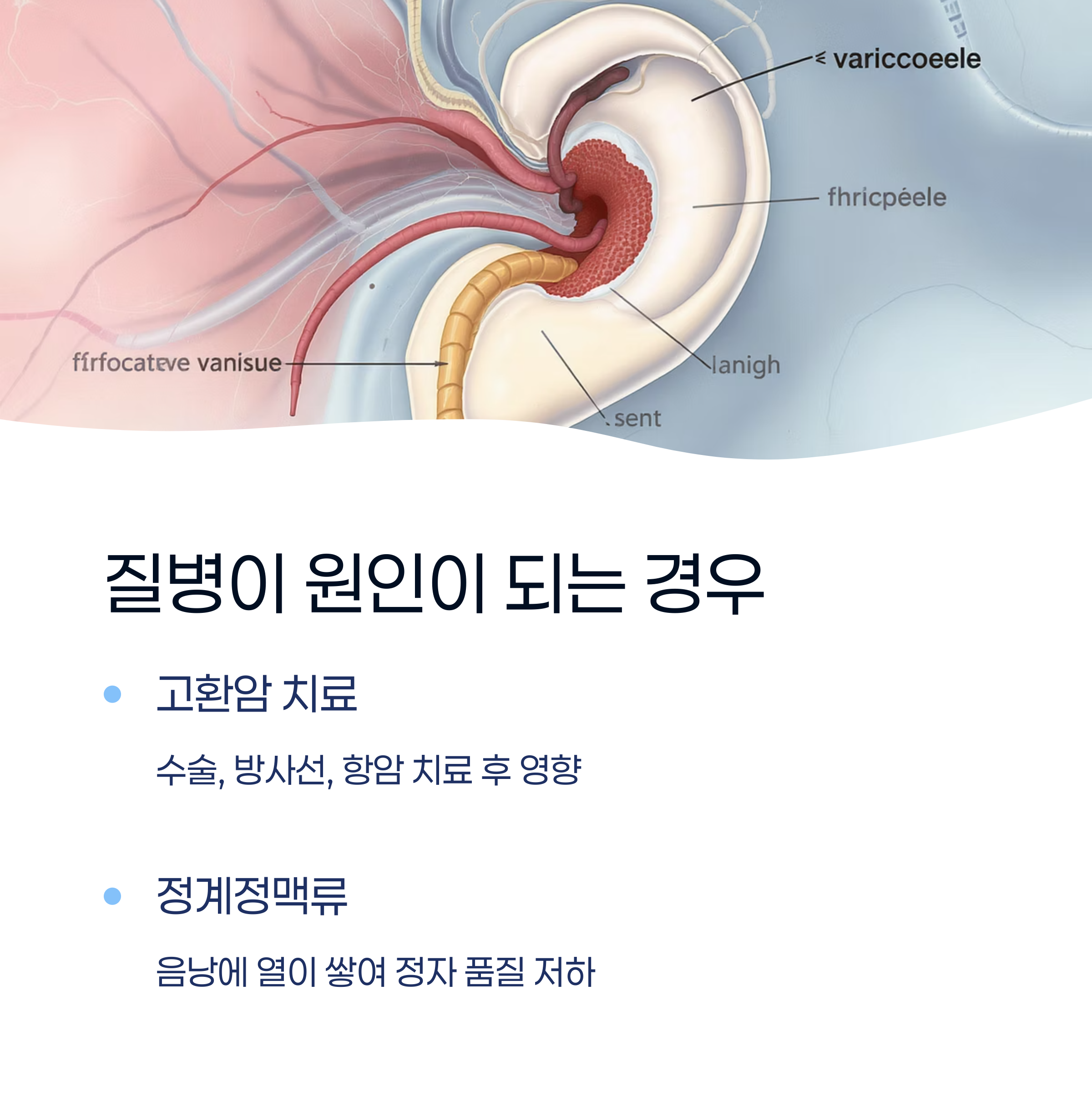 고환 단면 해부 일러스트와 함께 고환암 치료, 정계정맥류 등 질병이 정자 품질에 미치는 영향을 설명한 이미지