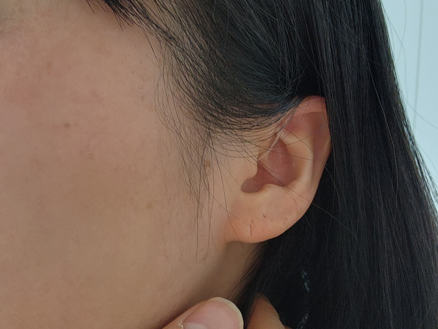 한쪽귀 난청 장애등급 이럴때는 크로스 보청기 