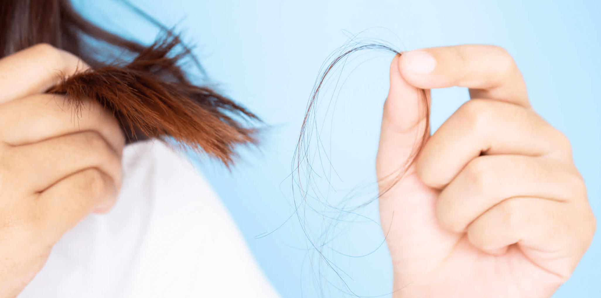 여성 탈모 원인