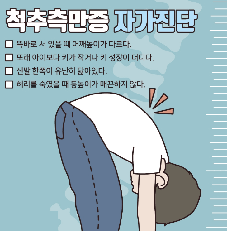 척추측만증 증상