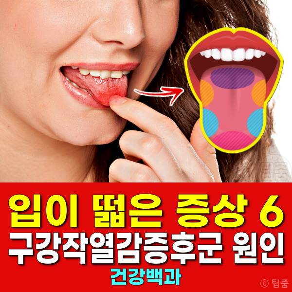 입이 떫은 증상 혀가 화끈거려요 구강작열감증후군 원인