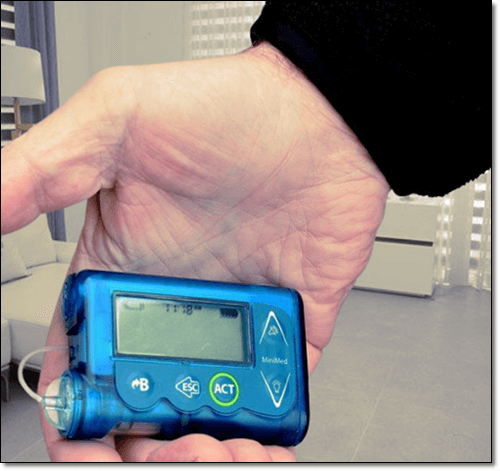 당뇨병 환자 혈당 확인