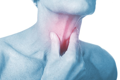 폐암초기증상01