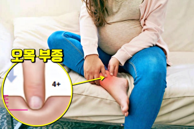 콩팥이 안좋을때 증상,눈 팔다리 붓기,콩팥이 안좋으면 나타나는 증상