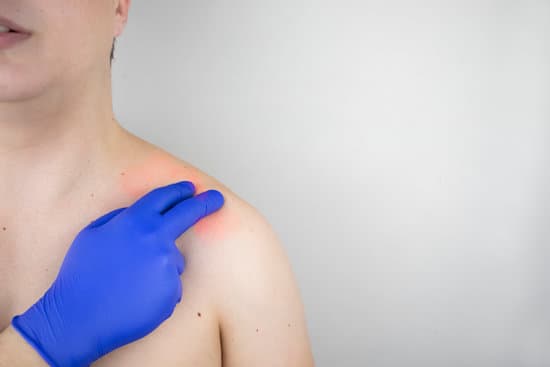 석회화건염(Calcific Tendinitis) – 힘줄에 석회가 쌓이는 염증성 질환