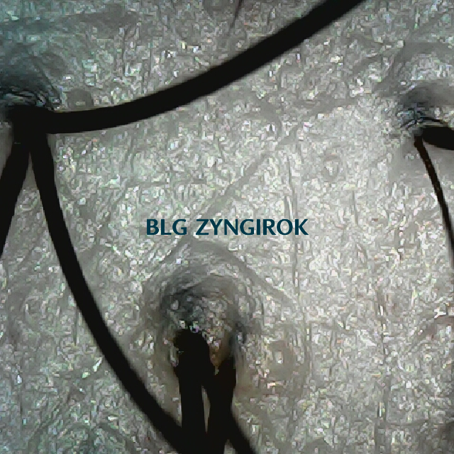 탈모 극복 프로젝트 - 뒷머리 두피 모습이다.