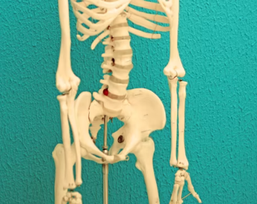 류마티스 관절염 치료법 진단 합병증