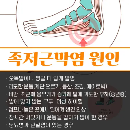 족저근막염