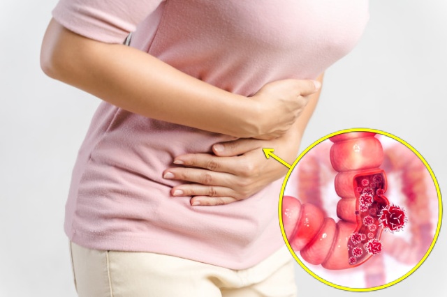 대장암 장게실염 장에 독소가 쌓이면, 장독소배출방법 장독소자가진단, 건강 팁줌 매일꿀정보