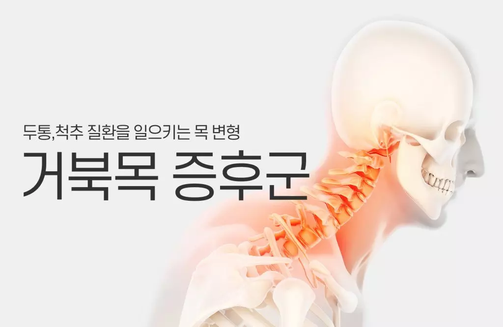 거북목증후군