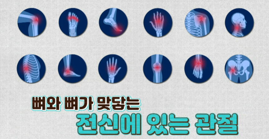 콘드로이친