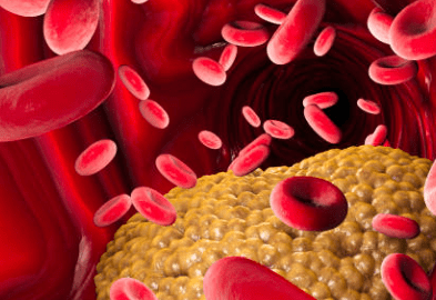 hdl 콜레스테롤 이란? 정상수치 및 높이는 방법