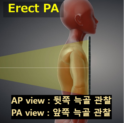 선자세 PA