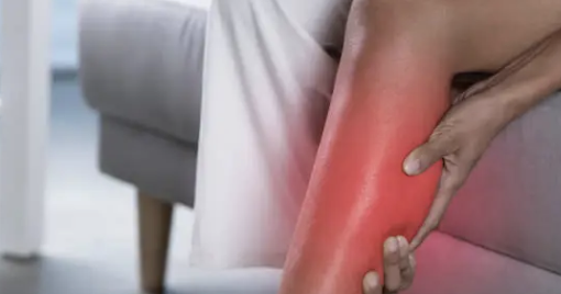 하지 정맥류 증상 20