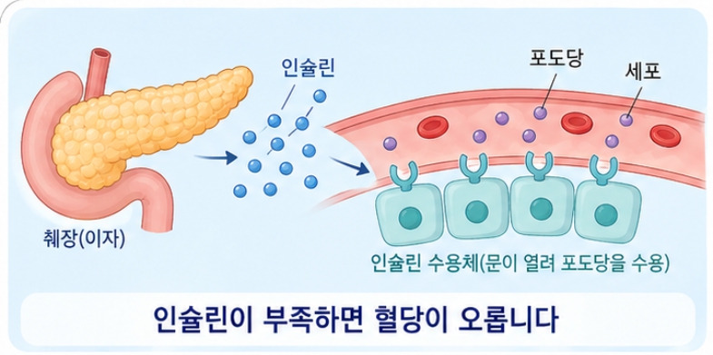 당뇨병이란 무엇인가 — 기본 개념과 종류