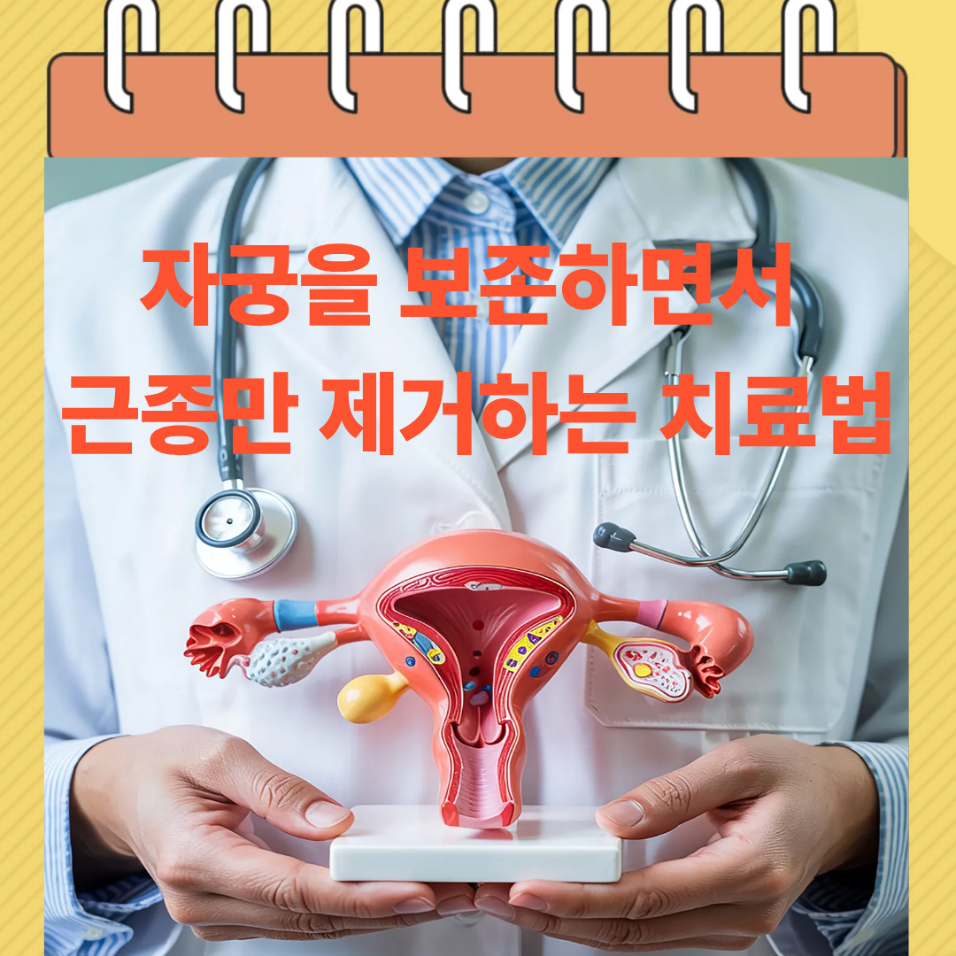 자궁을 보존하면서 근종만 제거하는 치료법