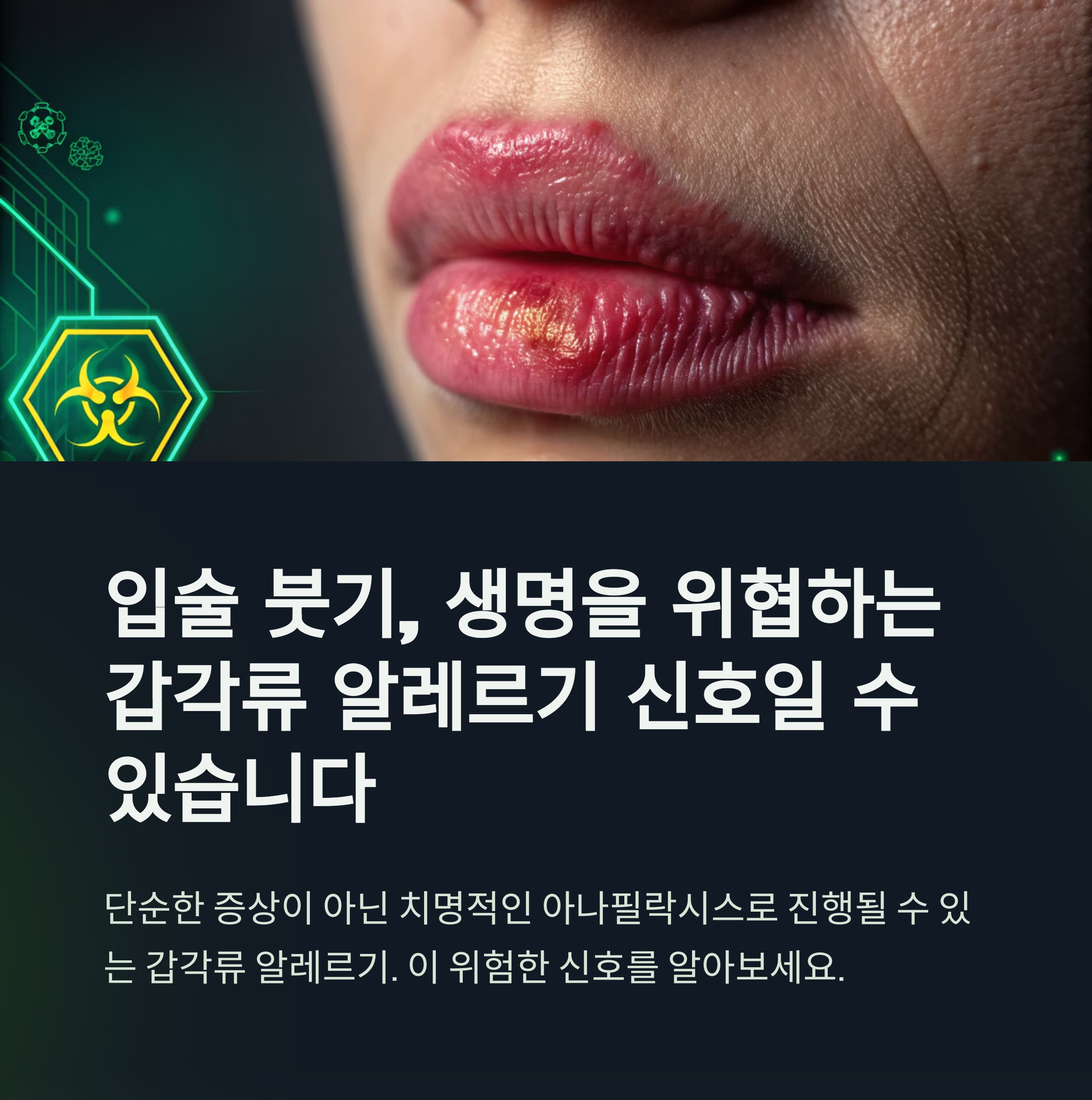 입술 붓기