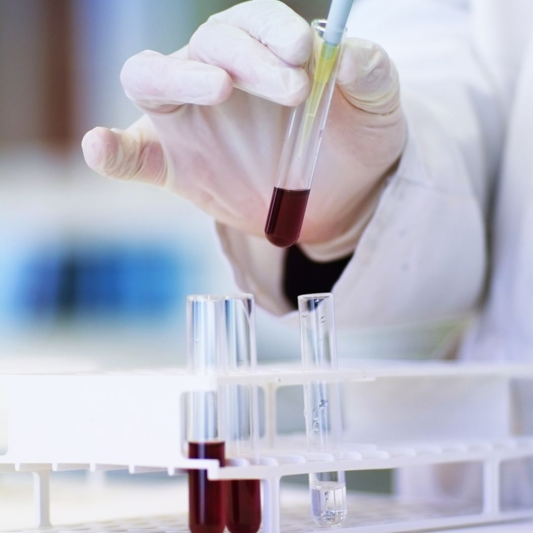 SK바이오사이언스