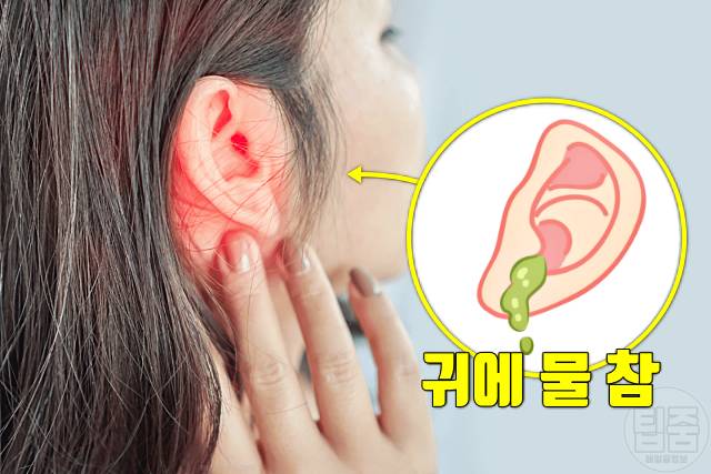비인두암 증상 귀가 먹먹하고 아픔 비염 증상 중이염