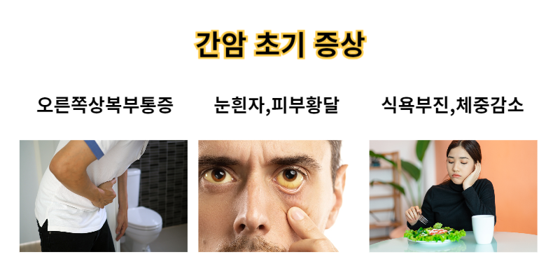 간암초기증상 이미지