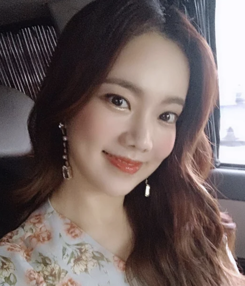 김나희 가수 성형